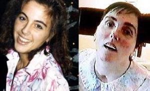 Terri Schiavo is dead